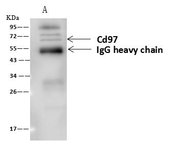 ADGRE5 / CD97 Antibody - Cd97 was immunoprecipitated using: Lane A: 0.5 mg NIH/3T3 Whole Cell Lysate. 4 uL anti-Cd97 rabbit polyclonal antibody and 60 ug of Immunomagnetic beads Protein A/G. Primary antibody: Anti-Cd97 rabbit polyclonal antibody, at 1:100 dilution. Secondary antibody: Goat Anti-Rabbit IgG (H+L)/HRP at 1/10000 dilution. Developed using the ECL technique. Performed under reducing conditions. Predicted band size: 92 kDa. Observed band size: 70 kDa.
