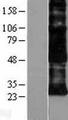 ADGRE5 / CD97 Protein - Western validation with an anti-DDK antibody * L: Control HEK293 lysate R: Over-expression lysate
