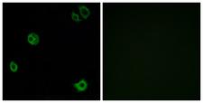 ADGRF1 / GPR110 Antibody - Immunofluorescence analysis of A549 cells, using GPR110 Antibody. The picture on the right is blocked with the synthesized peptide.