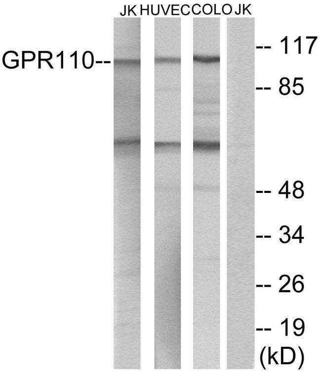ADGRF1 / GPR110 Antibody - Western blot analysis of lysates from Jurkat, HUVEC, and COLO cells, using GPR110 Antibody. The lane on the right is blocked with the synthesized peptide.