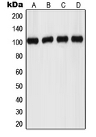 ADGRF1 / GPR110 Antibody - Western blot analysis of GPR110 expression in MCF7 (A); HeLa (B); mouse kidney (C); rat brain (D) whole cell lysates.