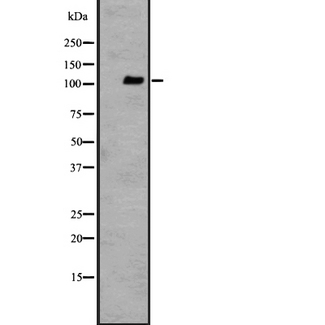 ADGRF1 / GPR110 Antibody - Western blot analysis of GPR110 expression in Jurkat cells lysate. The lane on the left is treated with the antigen-specific peptide.