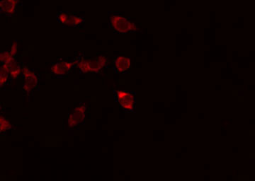 ADGRF1 / GPR110 Antibody - Staining HeLa cells by IF/ICC. The samples were fixed with PFA and permeabilized in 0.1% Triton X-100, then blocked in 10% serum for 45 min at 25°C. The primary antibody was diluted at 1:200 and incubated with the sample for 1 hour at 37°C. An Alexa Fluor 594 conjugated goat anti-rabbit IgG (H+L) Ab, diluted at 1/600, was used as the secondary antibody.