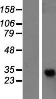 ADGRF1 / GPR110 Protein - Western validation with an anti-DDK antibody * L: Control HEK293 lysate R: Over-expression lysate
