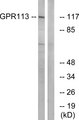 ADGRF3 / GPR113 Antibody - Western blot analysis of lysates from LOVO cells, using GPR113 Antibody. The lane on the right is blocked with the synthesized peptide.