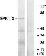 ADGRF4 / GPR115 Antibody - Western blot analysis of lysates from COLO205 cells, using GPR115 Antibody. The lane on the right is blocked with the synthesized peptide.