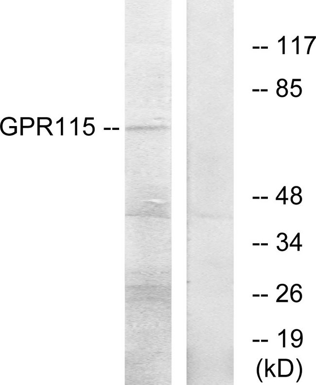 ADGRF4 / GPR115 Antibody - Western blot analysis of lysates from COLO205 cells, using GPR115 Antibody. The lane on the right is blocked with the synthesized peptide.