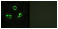 ADGRF4 / GPR115 Antibody - Immunofluorescence analysis of LOVO cells, using GPR115 Antibody. The picture on the right is blocked with the synthesized peptide.