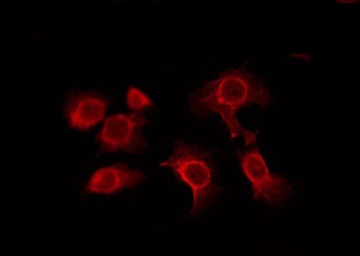 ADGRF4 / GPR115 Antibody - Staining RAW264.7 cells by IF/ICC. The samples were fixed with PFA and permeabilized in 0.1% Triton X-100, then blocked in 10% serum for 45 min at 25°C. The primary antibody was diluted at 1:200 and incubated with the sample for 1 hour at 37°C. An Alexa Fluor 594 conjugated goat anti-rabbit IgG (H+L) Ab, diluted at 1/600, was used as the secondary antibody.