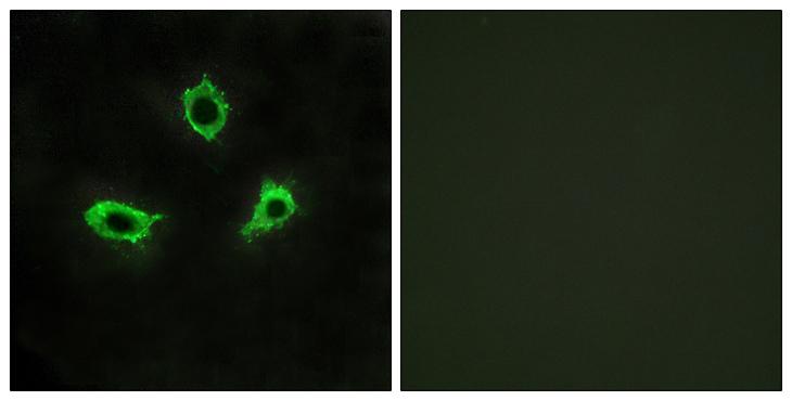 ADGRF4 / GPR115 Antibody - Peptide - + Immunofluorescence analysis of LOVO cells, using GPR115 antibody.