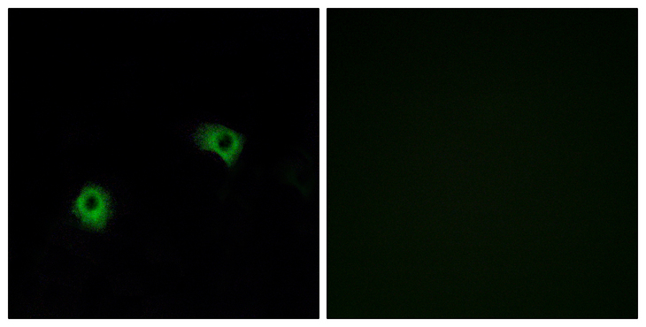 ADGRF5 / GPR116 Antibody - Immunofluorescence analysis of A549 cells, using GPR116 Antibody. The picture on the right is blocked with the synthesized peptide.