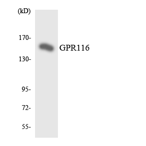 ADGRF5 / GPR116 Antibody - Western blot analysis of the lysates from HeLa cells using GPR116 antibody.