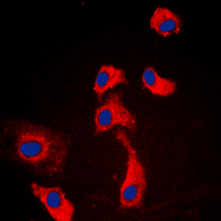 ADGRF5 / GPR116 Antibody - Immunofluorescent analysis of GPR116 staining in HEK293T cells. Formalin-fixed cells were permeabilized with 0.1% Triton X-100 in TBS for 5-10 minutes and blocked with 3% BSA-PBS for 30 minutes at room temperature. Cells were probed with the primary antibody in 3% BSA-PBS and incubated overnight at 4 C in a humidified chamber. Cells were washed with PBST and incubated with a DyLight 594-conjugated secondary antibody (red) in PBS at room temperature in the dark. DAPI was used to stain the cell nuclei (blue).