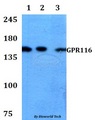 ADGRF5 / GPR116 Antibody - Western blot of GPR116 antibody at 1:500 dilution. Lane 1: HEK293T whole cell lysate. Lane 2: Raw264.7 whole cell lysate. Lane 3: PC12 whole cell lysate.
