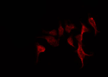 ADGRF5 / GPR116 Antibody - Staining A549 cells by IF/ICC. The samples were fixed with PFA and permeabilized in 0.1% Triton X-100, then blocked in 10% serum for 45 min at 25°C. The primary antibody was diluted at 1:200 and incubated with the sample for 1 hour at 37°C. An Alexa Fluor 594 conjugated goat anti-rabbit IgG (H+L) Ab, diluted at 1/600, was used as the secondary antibody.