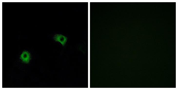 ADGRF5 / GPR116 Antibody - Peptide - + Immunofluorescence analysis of A549 cells, using GPR116 antibody.