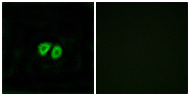 ADGRG1 / GPR56 Antibody - Immunofluorescence analysis of MCF7 cells, using GPR56 Antibody. The picture on the right is blocked with the synthesized peptide.