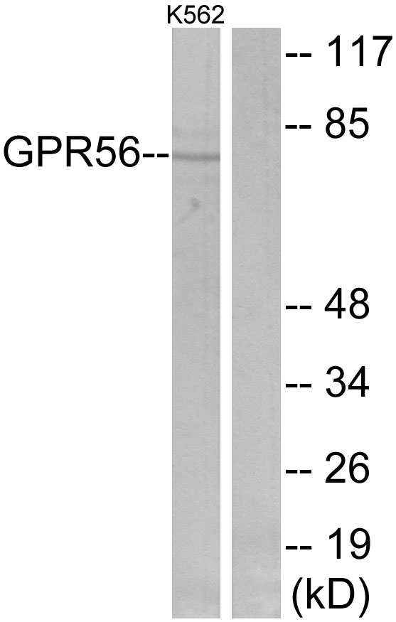 ADGRG1 / GPR56 Antibody - Western blot analysis of lysates from K562 cells, using GPR56 Antibody. The lane on the right is blocked with the synthesized peptide.