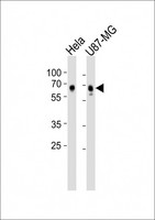 ADGRG1 / GPR56 Antibody - All lanes : Anti-GPR56 Antibody at 1:1000 dilution Lane 1: HeLa whole cell lysates Lane 2: U87-MG whole cell lysates Lysates/proteins at 20 ug per lane. Secondary Goat Anti-Rabbit IgG, (H+L), Peroxidase conjugated at 1/10000 dilution Predicted band size : 78 kDa Blocking/Dilution buffer: 5% NFDM/TBST.