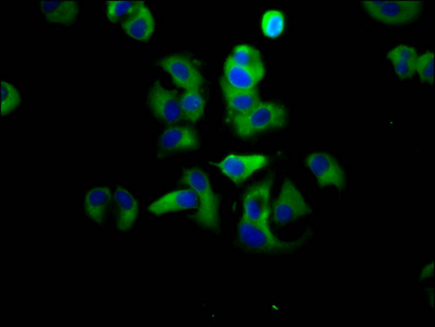 ADGRG1 / GPR56 Antibody - Immunofluorescence staining of MCF-7 cells diluted at 1:133, counter-stained with DAPI. The cells were fixed in 4% formaldehyde, permeabilized using 0.2% Triton X-100 and blocked in 10% normal Goat Serum. The cells were then incubated with the antibody overnight at 4°C.The Secondary antibody was Alexa Fluor 488-congugated AffiniPure Goat Anti-Rabbit IgG (H+L).