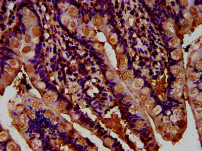 ADGRG1 / GPR56 Antibody - Immunohistochemistry Dilution at 1:400 and staining in paraffin-embedded human small intestine tissue performed on a Leica BondTM system. After dewaxing and hydration, antigen retrieval was mediated by high pressure in a citrate buffer (pH 6.0). Section was blocked with 10% normal Goat serum 30min at RT. Then primary antibody (1% BSA) was incubated at 4°C overnight. The primary is detected by a biotinylated Secondary antibody and visualized using an HRP conjugated SP system.