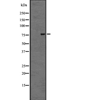 ADGRG1 / GPR56 Antibody - Western blot analysis of GPR56 expression in A431 whole cells lysate. The lane on the left is treated with the antigen-specific peptide.