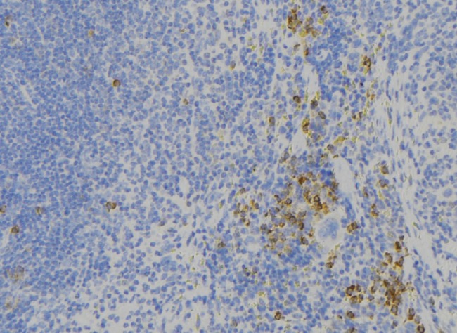 ADGRG1 / GPR56 Antibody - 1:100 staining human lymph node tissue by IHC-P. The sample was formaldehyde fixed and a heat mediated antigen retrieval step in citrate buffer was performed. The sample was then blocked and incubated with the antibody for 1.5 hours at 22°C. An HRP conjugated goat anti-rabbit antibody was used as the secondary.
