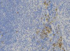 ADGRG1 / GPR56 Antibody - 1:100 staining human lymph node tissue by IHC-P. The sample was formaldehyde fixed and a heat mediated antigen retrieval step in citrate buffer was performed. The sample was then blocked and incubated with the antibody for 1.5 hours at 22°C. An HRP conjugated goat anti-rabbit antibody was used as the secondary.