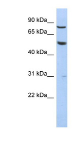 ADGRG1 / GPR56 Antibody - GPR56 antibody Western blot of HepG2 cell lysate. This image was taken for the unconjugated form of this product. Other forms have not been tested.