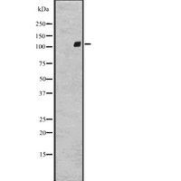 ADGRG2 / GPR64 Antibody - Western blot analysis of GPR64 expression in A431 whole cells lysate. The lane on the left is treated with the antigen-specific peptide.