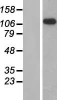 ADGRG2 / GPR64 Protein - Western validation with an anti-DDK antibody * L: Control HEK293 lysate R: Over-expression lysate