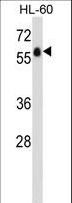 ADGRG3 / GPR97 Antibody - GPR97 Antibody western blot of HL-60 cell line lysates (35 ug/lane). The GPR97 antibody detected the GPR97 protein (arrow).