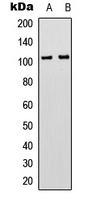 ADGRG3 / GPR97 Antibody - Western blot analysis of GPR97 expression in HeLa (A); HL60 (B) whole cell lysates.