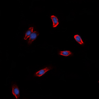 ADGRG3 / GPR97 Antibody - Immunofluorescent analysis of GPR97 staining in HeLa cells. Formalin-fixed cells were permeabilized with 0.1% Triton X-100 in TBS for 5-10 minutes and blocked with 3% BSA-PBS for 30 minutes at room temperature. Cells were probed with the primary antibody in 3% BSA-PBS and incubated overnight at 4 ??C in a humidified chamber. Cells were washed with PBST and incubated with a DyLight 594-conjugated secondary antibody (red) in PBS at room temperature in the dark. DAPI was used to stain the cell nuclei (blue).