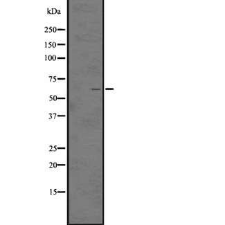 ADGRG3 / GPR97 Antibody - Western blot analysis of GPR97 expression in HL-60 cells line lysates. The lane on the left is treated with the antigen-specific peptide.