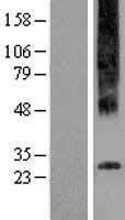 ADGRG3 / GPR97 Protein - Western validation with an anti-DDK antibody * L: Control HEK293 lysate R: Over-expression lysate