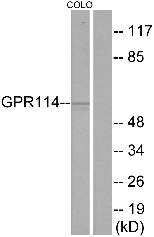 ADGRG5 /GPR114 Antibody - Western blot analysis of lysates from COLO205 cells, using GPR114 Antibody. The lane on the right is blocked with the synthesized peptide.