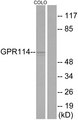 ADGRG5 /GPR114 Antibody - Western blot analysis of lysates from COLO205 cells, using GPR114 Antibody. The lane on the right is blocked with the synthesized peptide.