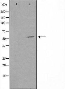 ADGRG5 /GPR114 Antibody - Western blot analysis of extracts of COLO cells using GPR114 antibody. The lane on the left is treated with the antigen-specific peptide.
