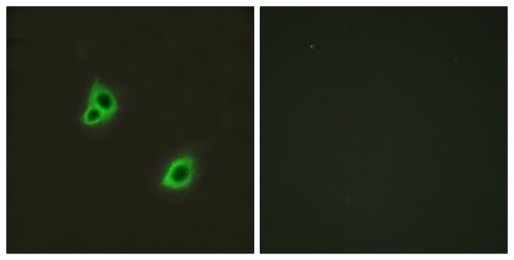 ADGRG6 / GPR126 Antibody - Immunofluorescence analysis of HUVEC cells, using GPR126 Antibody. The picture on the right is blocked with the synthesized peptide.