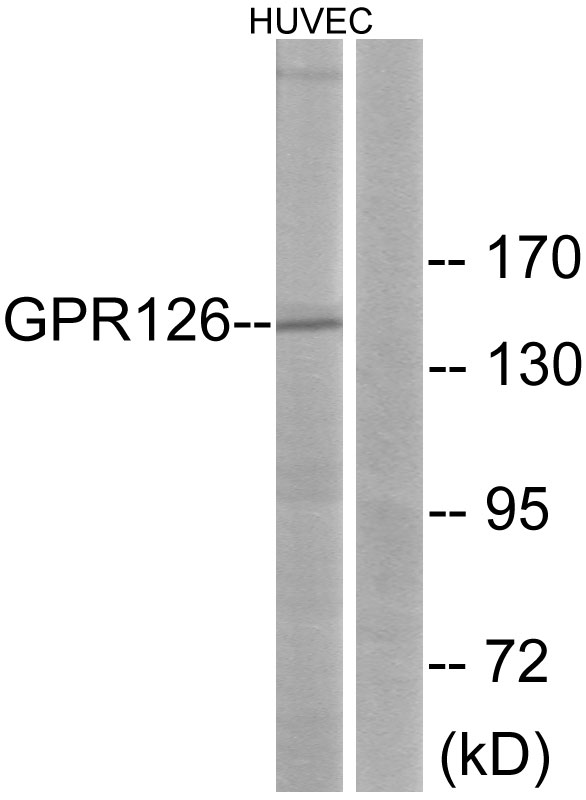 ADGRG6 / GPR126 Antibody - Western blot analysis of lysates from HUVEC cells, using GPR126 Antibody. The lane on the right is blocked with the synthesized peptide.