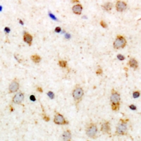 ADGRG6 / GPR126 Antibody - Immunohistochemical analysis of GPR126 staining in human brain formalin fixed paraffin embedded tissue section. The section was pre-treated using heat mediated antigen retrieval with sodium citrate buffer (pH 6.0). The section was then incubated with the antibody at room temperature and detected using an HRP polymer system. DAB was used as the chromogen. The section was then counterstained with hematoxylin and mounted with DPX.