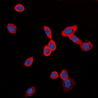 ADGRG6 / GPR126 Antibody - Immunofluorescent analysis of GPR126 staining in LOVO cells. Formalin-fixed cells were permeabilized with 0.1% Triton X-100 in TBS for 5-10 minutes and blocked with 3% BSA-PBS for 30 minutes at room temperature. Cells were probed with the primary antibody in 3% BSA-PBS and incubated overnight at 4 deg C in a humidified chamber. Cells were washed with PBST and incubated with a DyLight 594-conjugated secondary antibody (red) in PBS at room temperature in the dark. DAPI was used to stain the cell nuclei (blue).
