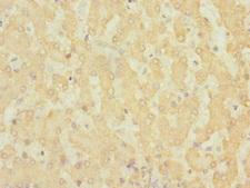 ADGRG6 / GPR126 Antibody - Immunohistochemistry of paraffin-embedded human liver tissue at dilution 1:100
