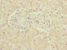 ADGRG6 / GPR126 Antibody - Immunohistochemistry of paraffin-embedded human liver tissue at dilution 1:100