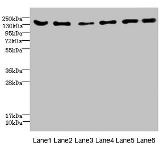 ADGRG6 / GPR126 Antibody - Western blot All Lanes: CD1C antibody at 4.61ug/ml Lane 1: Mouse brain tissue Lane 2: Mouse lung tissue Lane 3: 293T whole cell lysate Lane 4: HepG-2 whole cell lysate Lane 5: Jurkat whole cell lysate Lane 6: Hela whole cell lysate Secondary Goat polyclonal to rabbit IgG at 1/10000 dilution Predicted band size: 137,134,140 kDa Observed band size: 137 kDa