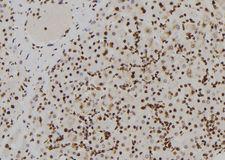 ADGRG7 / GPR128 Antibody - 1:100 staining human liver tissue by IHC-P. The sample was formaldehyde fixed and a heat mediated antigen retrieval step in citrate buffer was performed. The sample was then blocked and incubated with the antibody for 1.5 hours at 22°C. An HRP conjugated goat anti-rabbit antibody was used as the secondary.