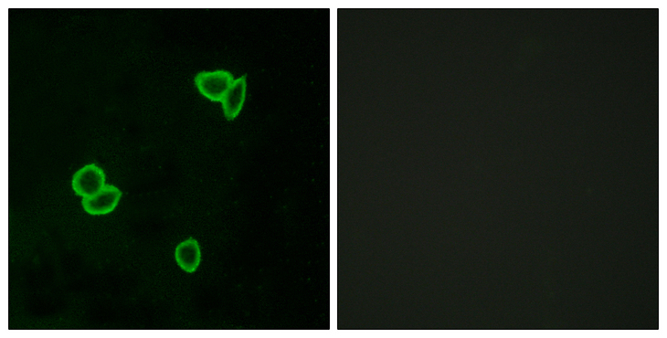 ADGRL1 / LPHN1 Antibody - Immunofluorescence analysis of LOVO cells, using LPHN1 Antibody. The picture on the right is blocked with the synthesized peptide.