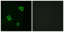 ADGRL1 / LPHN1 Antibody - Immunofluorescence analysis of LOVO cells, using LPHN1 Antibody. The picture on the right is blocked with the synthesized peptide.