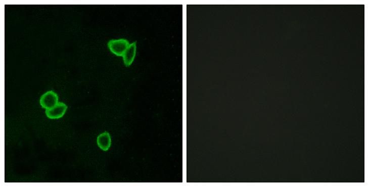 ADGRL1 / LPHN1 Antibody - Peptide - + Immunofluorescence analysis of LOVO cells, using LPHN1 antibody.